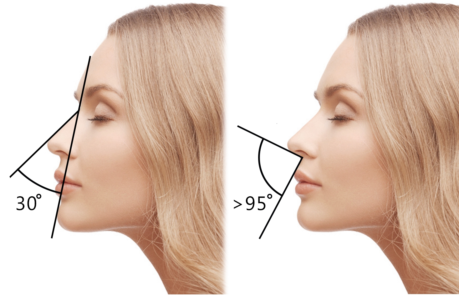 пропорции носа